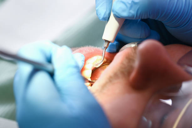 Best Emergency Orthodontic Repairs in Burlington, IA