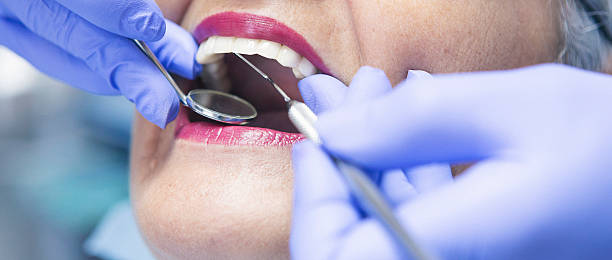 Best Emergency Treatment for Toothache in Burlington, IA